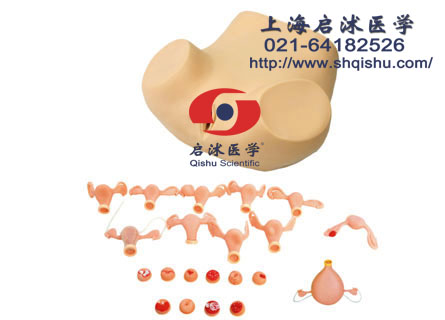 高級(jí)婦科檢查訓(xùn)練模型