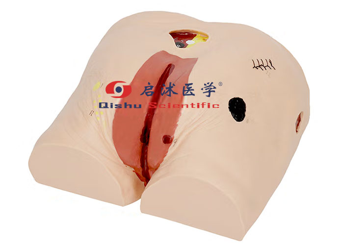 高級褥瘡護(hù)理模型